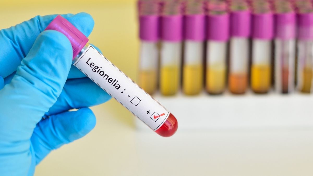 legionella acs